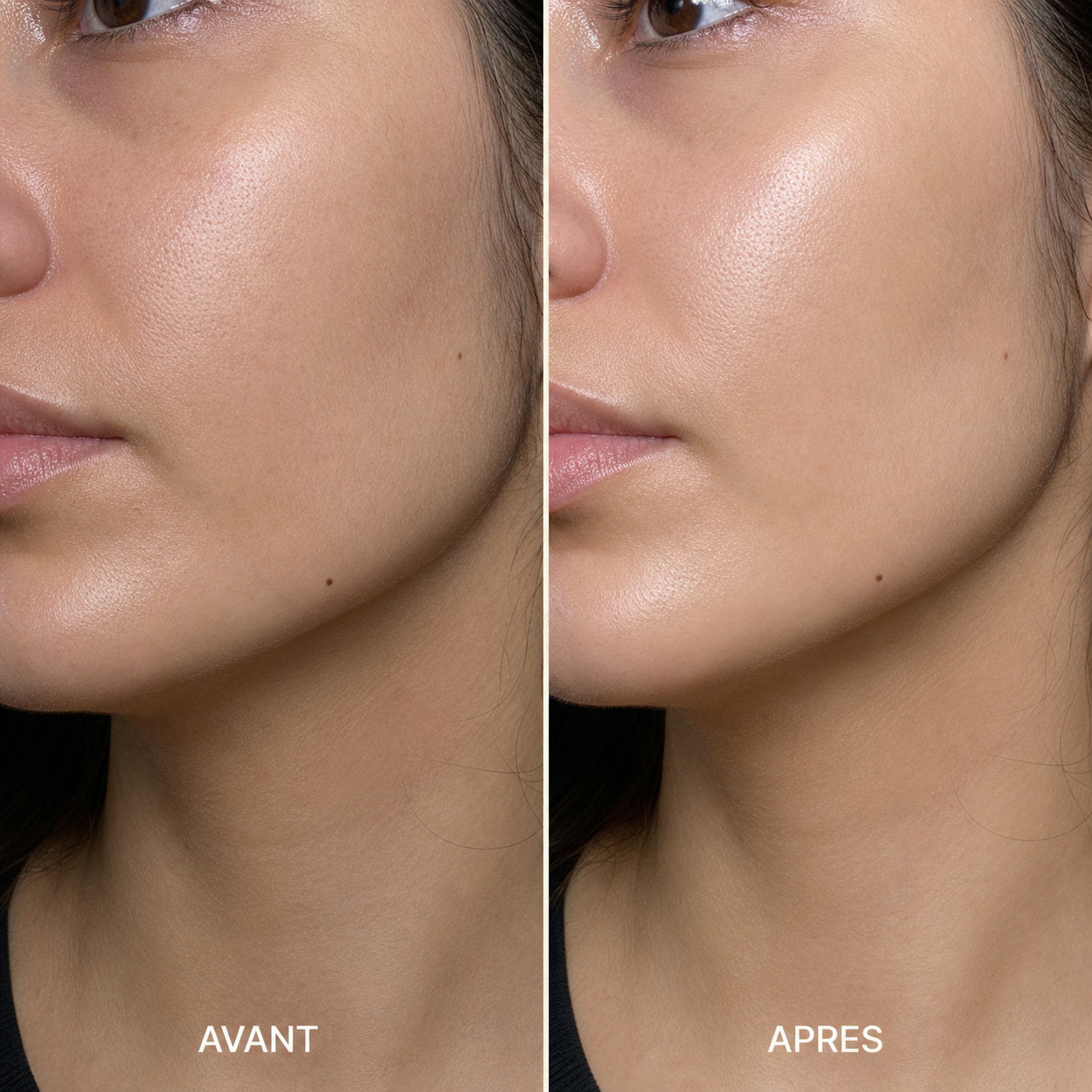 appareil-lifting-visage-rose-image31.jpg