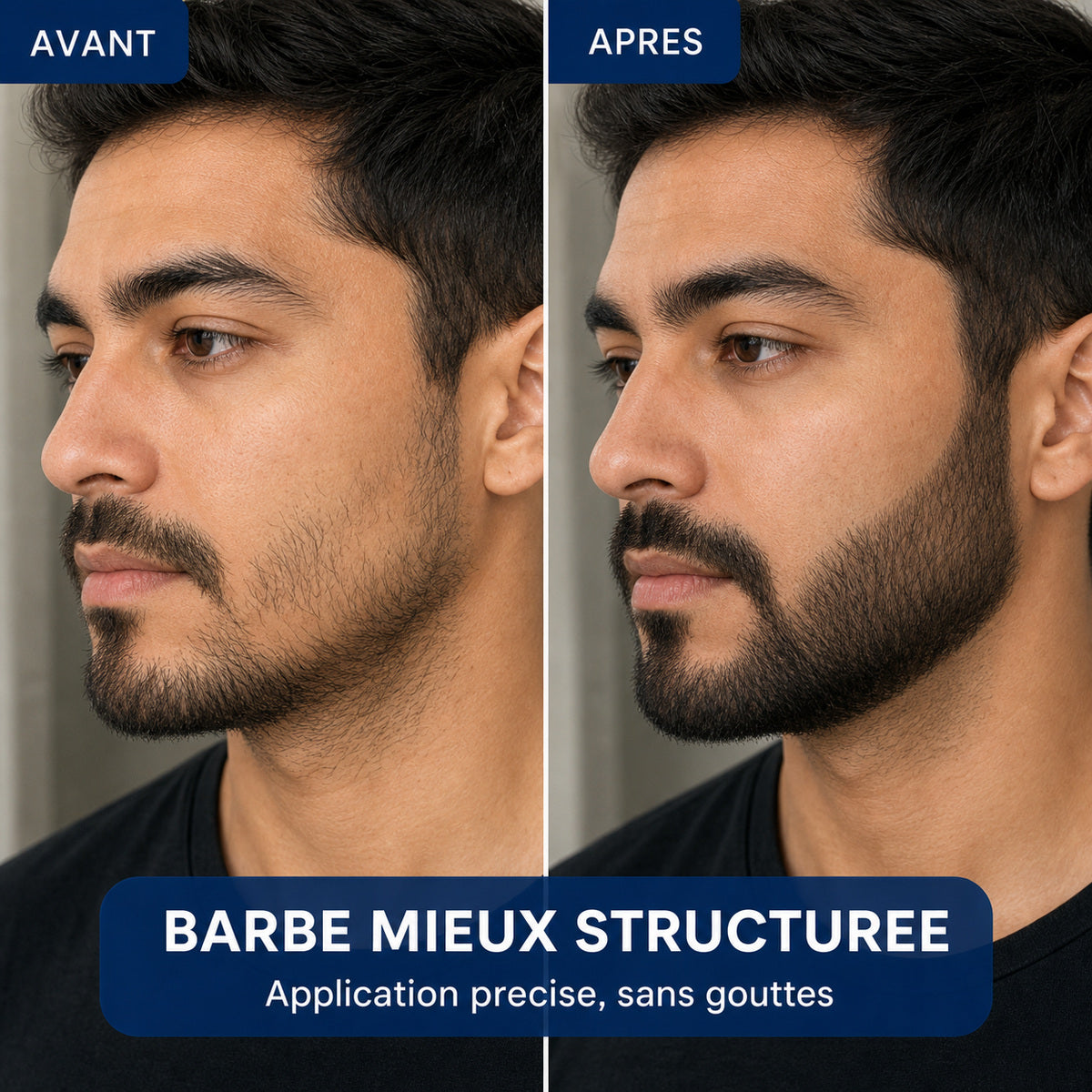 serum-roll-on-densite-cheveux-homme-image21.jpg