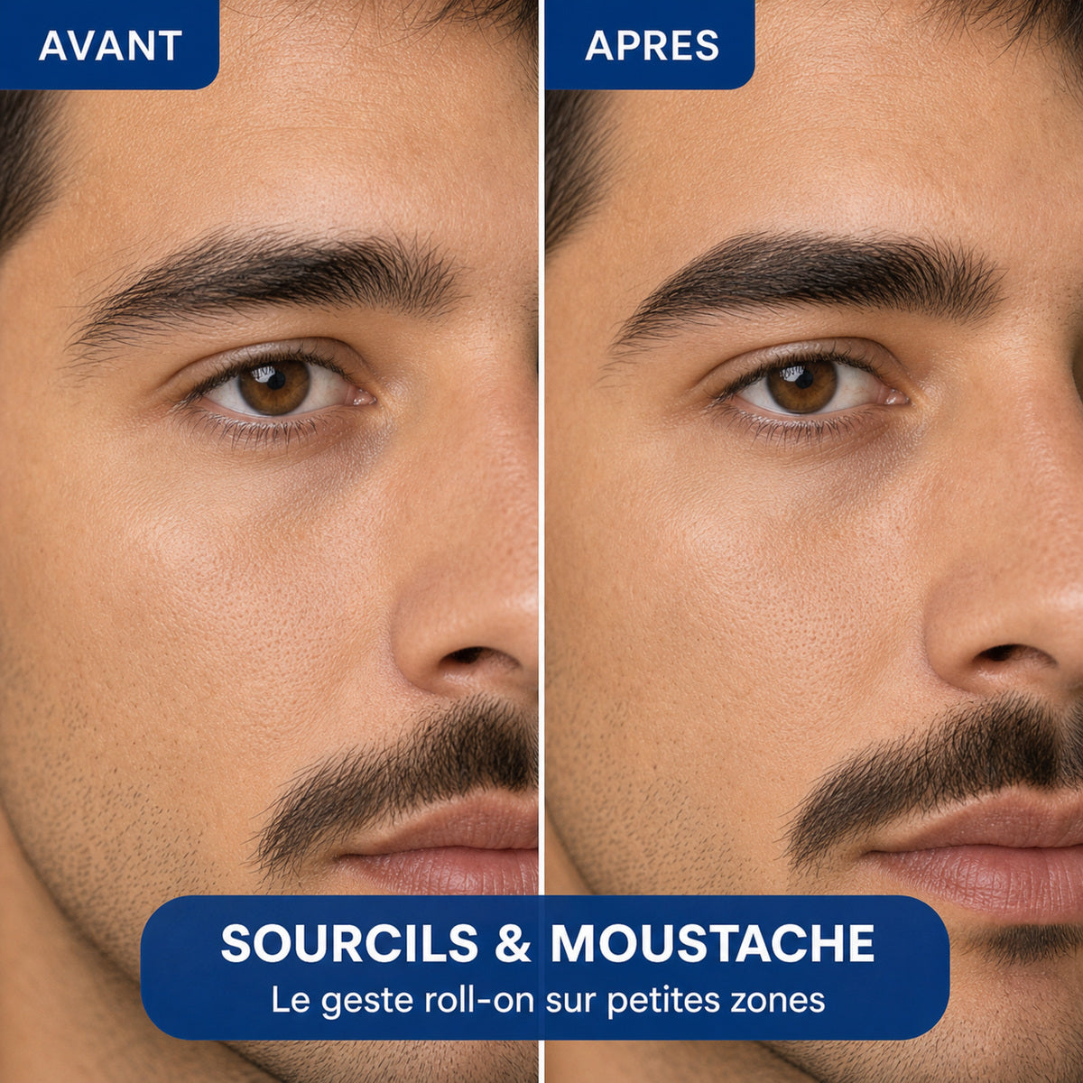 serum-roll-on-densite-cheveux-homme-image31.jpg